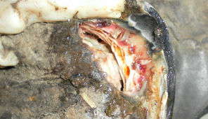 Ein Abszess kann begleitend oder als die Folge einer Hufrehe entstehen. Bei diesem Huf griff er, lange unbemerkt, den Bereich um die Hufbeinspitze an.